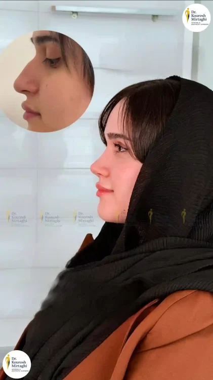 دکتر میرتقی جراح بینی