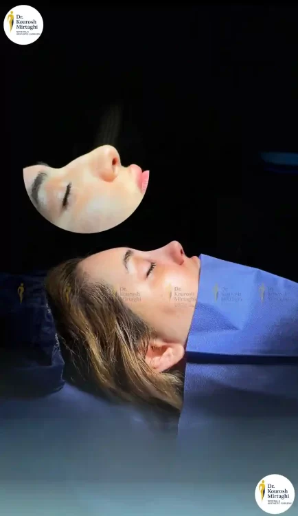 رینوپلاستی دکتر میرتقی